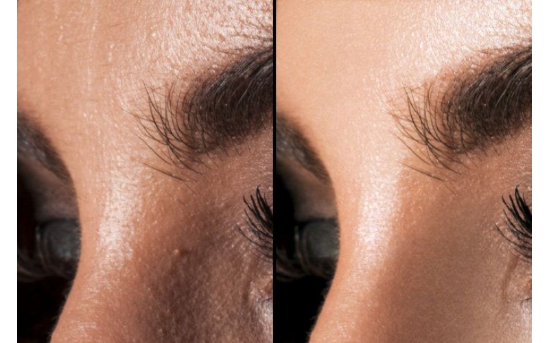 PS修圖實例Photoshop磨皮技術